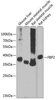 WB analysis of various sample lysates using GTX66583 FBP2 antibody. Dilution : 1:1000 Loading : 25microg per lane WB analysis of various sample lysates using GTX66583 FBP2 antibody. Dilution : 1:1000 Loading : 25microg per lane