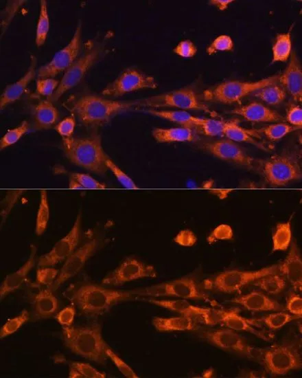 ICC/IF analysis of NIH/3T3 cells using GTX66593 SUPV3L1 antibody. Blue : DAPI Dilution : 1:100