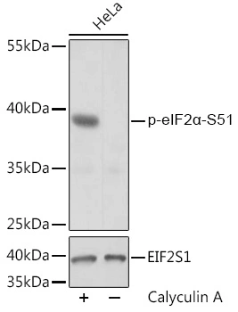 WB analysis of HeLa cells treated by Calyculin A (100nM) for 30 minutes after serum-starvation overnight using GTX66600 eIF2 alpha (phospho Ser51) antibody. Dilution : 1:2000 Loading : 25microg per lane