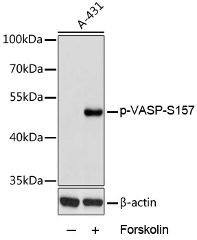 WB analysis of A431 cells treated by Forskolin (10uM) for 30 minutes after serum-starvation overnight using GTX66601 VASP (phospho Ser157) antibody. Dilution : 1:2000 Loading : 25microg per lane