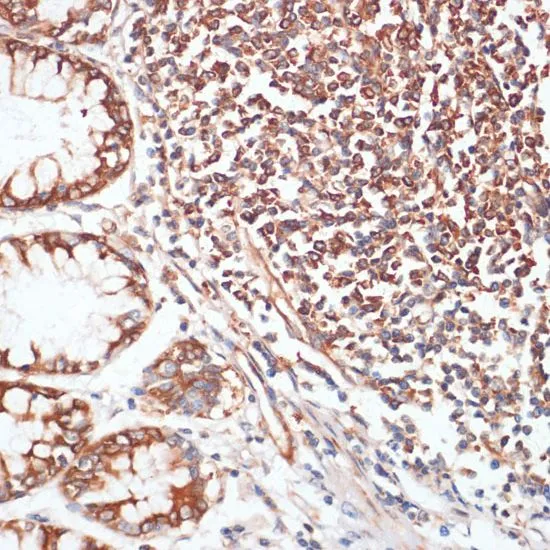 IHC-P analysis of human colon tissue using GTX66601 VASP (phospho Ser157) antibody. Dilution : 1:100