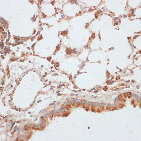 IHC-P analysis of mouse lung tissue using GTX66601 VASP (phospho Ser157) antibody. Dilution : 1:100