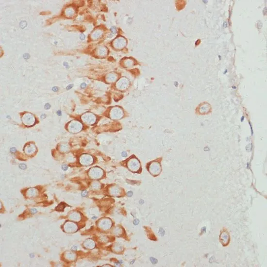 IHC-P analysis of rat brain tissue using GTX66601 VASP (phospho Ser157) antibody. Dilution : 1:100