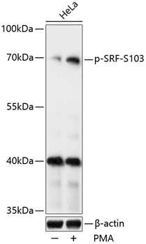 WB analysis of HeLa cells treated by PMA/TPA (200nM) for 15 minutes after serum-starvation overnight using GTX66603 SRF (phospho Ser103) antibody. Dilution : 1:1000 Loading : 25microg per lane WB analysis of HeLa cells treated by PMA/TPA (200nM) for 15 minutes after serum-starvation overnight using GTX66603 SRF (phospho Ser103) antibody. Dilution : 1:1000 Loading : 25microg per lane