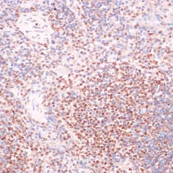 IHC-P analysis of mouse spleen tissue using GTX66603 SRF (phospho Ser103) antibody. Dilution : 1:100