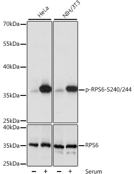 WB analysis of HeLa cells treated by 10% FBS at 37oC for 30 minutes after serum-starvation overnight and NIH/3T3 cells treated by 10% FBS at 37oC for 30 minutes after serum-starvation overnight using GTX66604 RPS6 (phospho Ser240/Ser244) antibody. Dilution : 1:1000 Loading : 25microg per lane