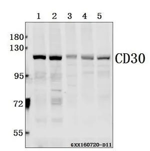 WB analysis of various samples using GTX66609 CD30 antibody. Lane1 : MCF-7 whole cell lysate(40ug) Lane2 : HEK293T whole cell lysate(40ug) Lane3 : PC12 whole cell lysate(40ug) Lane4 : BV2 whole cell lysate(40ug) Lane5 : The Kidney tissue lysate of Mouse(40ug) Dilution : 1:500 WB analysis of various samples using GTX66609 CD30 antibody. Lane1 : MCF-7 whole cell lysate(40ug) Lane2 : HEK293T whole cell lysate(40ug) Lane3 : PC12 whole cell lysate(40ug) Lane4 : BV2 whole cell lysate(40ug) Lane5 : The Kidney tissue lysate of Mouse(40ug) Dilution : 1:500