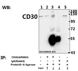 IP analysis of rat testis tissue lysate using GTX66610 CD30 antibody (Lane 2 and 3) and nonspecific IgG control antibody (Lane 4 and 5) compared to the input control (Lane 1). Upward arrow : supernatant Downward arrow : Immunoprecipitants IP analysis of rat testis tissue lysate using GTX66610 CD30 antibody (Lane 2 and 3) and nonspecific IgG control antibody (Lane 4 and 5) compared to the input control (Lane 1). Upward arrow : supernatant Downward arrow : Immunoprecipitants