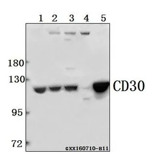WB analysis of various samples using GTX66610 CD30 antibody. Lane1 : HCT116 whole cell lysate(40ug) Lane2 : MCF-7 whole cell lysate(40ug) Lane3 : CT26 whole cell lysate(40ug) Dilution : 1:1000