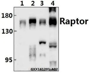 WB analysis of various samples using GTX66611 Raptor antibody. Lane 1 : The Testis tissue lysate of Mouse(40ug) Lane2 : The Testis tissue lysate of Rat(40ug) Lane3 : HCC827 whole cell lysate(40ug) Lane4 : L02 whole cell lysate(40ug) Dilution : 1:500 WB analysis of various samples using GTX66611 Raptor antibody. Lane 1 : The Testis tissue lysate of Mouse(40ug) Lane2 : The Testis tissue lysate of Rat(40ug) Lane3 : HCC827 whole cell lysate(40ug) Lane4 : L02 whole cell lysate(40ug) Dilution : 1:500