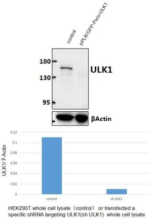 WB analysis of extracts from HEK293T (control) or ULK1 shRNA transfected cells using GTX66613 ULK1 antibody.