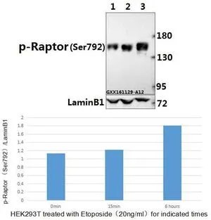 WB analysis of various samples using GTX66614 Raptor (phospho Ser792) antibody. Lane1 : HEK293T whole cell lysate Lane2 : HEK293T treated with Etoposide(20ng/ml) for 15 minutes whole cell lysate Lane3 : HEK293T treated with Etoposide(20ng/ml) for 6 hours whole cell lysate Dilution : 1:500 WB analysis of various samples using GTX66614 Raptor (phospho Ser792) antibody. Lane1 : HEK293T whole cell lysate Lane2 : HEK293T treated with Etoposide(20ng/ml) for 15 minutes whole cell lysate Lane3 : HEK293T treated with Etoposide(20ng/ml) for 6 hours whole cell lysate Dilution : 1:500