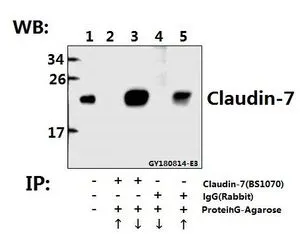 IP analysis of Hela cell lysate using GTX66616 Claudin 7 antibody (Lane 2 and 3) and nonspecific IgG control antibody (Lane 4 and 5) compared to the input control (Lane 1). Upward arrow : supernatant Downward arrow : Immunoprecipitants