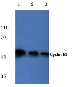 WB analysis of various samples using GTX66618 Cyclin E1 antibody. Lane1 : MCF-7 cell lysate Lane2 : Mouse liver tissue lysate Lane3 : Rat kidney tissue lysate Dilution : 1:500