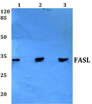WB analysis of various samples using GTX66619 Fas Ligand antibody. Lane1 : Hela whole cell lysate Lane2 : NIH-3T3 whole cell lysate Lane3 : PC12 whole cell lysate Dilution : 1:500