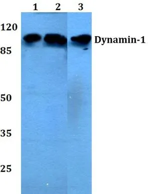 WB analysis of various samples using GTX66629 Dynamin 1 antibody. Lane1 : HCT116 whole cell lysate(40ug) Lane2 : MCF-7 whole cell lysate(40ug) Lane3 : PC12 whole cell lysate(40ug) Lane4 : CT26 whole cell lysate(40ug) Dilution : 1:500