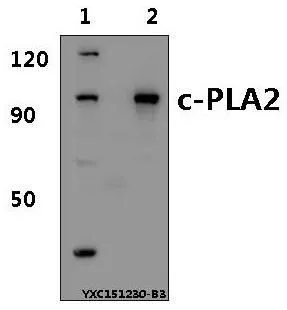 WB analysis of various samples using GTX66631 PLA2G4A antibody. Lane1 : A549 whole cell lysate(40microg) Lane2 : BV2 whole cell lysate(15microg) Dilution : 1:500