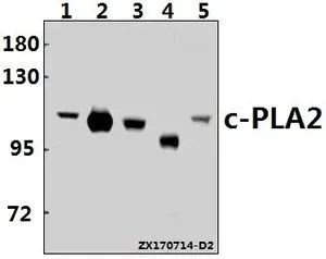 WB analysis of various samples using GTX66631 PLA2G4A antibody. Lane1 : THP-1 whole cell lysate(40ug) Lane2 : MEF whole cell lysate(10ug) Lane3 : H9C2 whole cell lysate(40ug) Lane4 : K562 whole cell lysate(10ug) Lane5 : Jurkat whole cell lysate(40ug) Dilution : 1:500