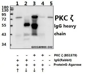 IP analysis of mouse lung tissue lysate using GTX66637 PKC zeta antibody (Lane 1 and 2) and nonspecific IgG control antibody (Lane 3 and 4) compared to the input control (Lane 5). Upward arrow : supernatant Downward arrow : Immunoprecipitants