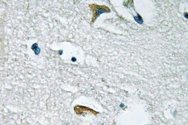 IHC-P analysis of human brain tissue using GTX66640 JAK3 antibody. IHC-P analysis of human brain tissue using GTX66640 JAK3 antibody.