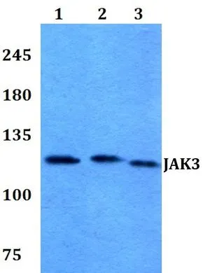 WB analysis of various samples using GTX66640 JAK3 antibody. Lane1 : HEK293T whole cell lysate Lane2 : sp2/0 whole cell lysate Lane3 : PC12 whole cell lysate Dilution : 1:500