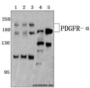 WB analysis of various samples using GTX66642 PDGF Receptor alpha antibody. Lane1 : SGC-7901 whole cell lysate(40ug) Lane2 : SK-OVCAR3 whole cell lysate(40ug) Lane3 : HEK293T whole cell lysate(40ug) Lane4 : The brain tissue lysate of Mouse(40ug) Lane5 : The brain tissue lysate of Rat(40ug) Dilution : 1:500
