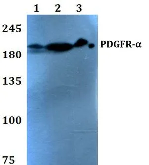 WB analysis of various samples using GTX66642 PDGF Receptor alpha antibody. Lane1 : HEK293T whole cell lysate Lane2 : sp2/0 whole cell lysate Lane3 : PC12 whole cell lysate Dilution : 1:500