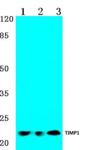 WB analysis of various samples using GTX66643 TIMP1 antibody. Lane1 : Hela cell lysate Lane2 : Mouse kidney tissue lysate Lane3 : H9C2 cell lysate Dilution : 1:500 WB analysis of various samples using GTX66643 TIMP1 antibody. Lane1 : Hela cell lysate Lane2 : Mouse kidney tissue lysate Lane3 : H9C2 cell lysate Dilution : 1:500
