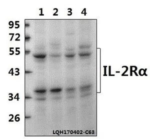 WB analysis of various samples using GTX66646 IL2 Receptor alpha antibody. Lane1 : PC3 whole cell lysate(40ug) Lane2 : A549 whole cell lysate(40ug) Lane3 : PMVEC whole cell lysate(40ug) Lane4 : BV2 whole cell lysate(40ug) Dilution : 1:500 WB analysis of various samples using GTX66646 IL2 Receptor alpha antibody. Lane1 : PC3 whole cell lysate(40ug) Lane2 : A549 whole cell lysate(40ug) Lane3 : PMVEC whole cell lysate(40ug) Lane4 : BV2 whole cell lysate(40ug) Dilution : 1:500