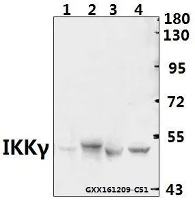 WB analysis of various samples using GTX66648 IKK gamma antibody. Lane1 : The Kidney tissue lysate of Mouse(40ug) Lane2 : The Kidney tissue lysate of Rat(40ug) Lane3 : Panc1 whole cell lysate(40ug) Lane4 : A549 whole cell lysate(40ug) Dilution : 1:500