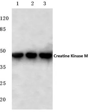 WB analysis of various samples using GTX66650 Creatine kinase (muscle) antibody. Lane1 : Hela cell lysate Lane2 : NIH-3T3 cell lysate Lane3 : H9C2 cell lysate Dilution : 1:500