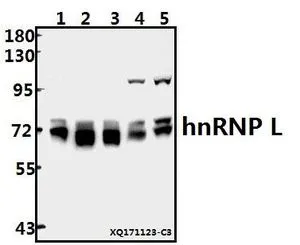 WB analysis of various samples using GTX66652 hnRNP L antibody. Lane1 : MCF-7 whole cell lysate(10ug) Lane2 : A549 whole cell lysate(10ug) Lane3 : K562 whole cell lysate(10ug) Lane4 : The Uterus tissue lysate of Rat(20ug) Lane5 : The Brain tissue lysate of Mouse(40ug) Dilution : 1:500