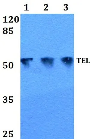 WB analysis of various samples using GTX66653 TEL antibody. Lane1 : HEK293T whole cell lysate Lane2 : Raw264.7 whole cell lysate Lane3 : PC12 whole cell lysate Dilution : 1:500 WB analysis of various samples using GTX66653 TEL antibody. Lane1 : HEK293T whole cell lysate Lane2 : Raw264.7 whole cell lysate Lane3 : PC12 whole cell lysate Dilution : 1:500