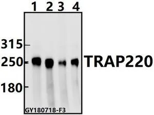 WB analysis of various samples using GTX66658 MED1 antibody. Lane1 : A549 whole cell lysate(40ug) Lane2 : HEK293T whole cell lysate(40ug) Lane3 : PC12 whole cell lysate(40ug) Lane4 : CT26 whole cell lysate(40ug) Dilution : 1:500