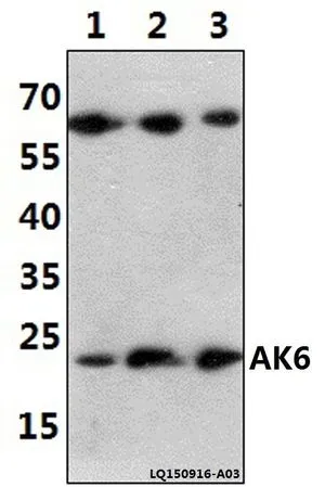 WB analysis of various samples using GTX66662 AK6 antibody. Lane1 : A549 whole cell lysate(40ug) Lane2 : The Lung tissue lysate of Rat(30ug) Lane3 : The Lung tissue lysate of Mouse(30ug) Dilution : 1:1000