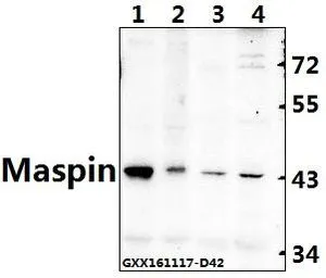 WB analysis of various samples using GTX66666 Maspin antibody. Lane1 : A549 whole cell lysate Lane2 : Raw264.7 whole cell lysate Lane3 : H9C2 whole cell lysate Lane4 : Hela whole cell lysate Dilution : 1:500