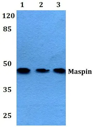 WB analysis of various samples using GTX66666 Maspin antibody. Lane1 : A549 whole cell lysate Lane2 : Raw264.7 whole cell lysate Lane3 : H9C2 whole cell lysate Dilution : 1:500