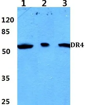WB analysis of various samples using GTX66667 DR4 antibody. Lane1 : MCF-7 cell lysate Lane2 : Mouse heart tissue lysate Lane3 : Rat heart tissue lysate Dilution : 1:500 WB analysis of various samples using GTX66667 DR4 antibody. Lane1 : MCF-7 cell lysate Lane2 : Mouse heart tissue lysate Lane3 : Rat heart tissue lysate Dilution : 1:500