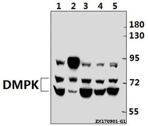 WB analysis of various samples using GTX66672 DMPK antibody. Lane1 : CT26 whole cell lysate(40ug) Lane2 : The Brain tissue lysate of Rat(40ug) Lane3 : A549 whole cell lysate(40ug) Lane4 : L02 whole cell lysate(40ug) Lane5 : HEK293T whole cell lysate(20ug) Dilution : 1:500 WB analysis of various samples using GTX66672 DMPK antibody. Lane1 : CT26 whole cell lysate(40ug) Lane2 : The Brain tissue lysate of Rat(40ug) Lane3 : A549 whole cell lysate(40ug) Lane4 : L02 whole cell lysate(40ug) Lane5 : HEK293T whole cell lysate(20ug) Dilution : 1:500