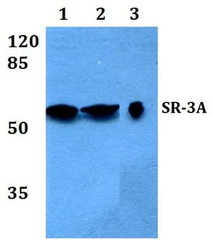 WB analysis of various samples using GTX66674 5-HT3A receptor antibody. Lane1 : A540 whole cell lysate Lane2 : Mouse brain tissue lysate Lane3 : Rat brain tissue lysate Dilution : 1:500 WB analysis of various samples using GTX66674 5-HT3A receptor antibody. Lane1 : A540 whole cell lysate Lane2 : Mouse brain tissue lysate Lane3 : Rat brain tissue lysate Dilution : 1:500