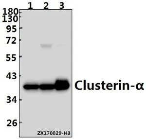 WB analysis of various samples using GTX66676 Clusterin alpha antibody. Lane1 : Hela whole cell lysate(40ug) Lane2 : A549 whole cell lysate(40ug) Lane3 : SGC7901 whole cell lysate(40ug) Dilution : 1:500 WB analysis of various samples using GTX66676 Clusterin alpha antibody. Lane1 : Hela whole cell lysate(40ug) Lane2 : A549 whole cell lysate(40ug) Lane3 : SGC7901 whole cell lysate(40ug) Dilution : 1:500