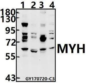 WB analysis of various samples using GTX66680 MUTYH antibody. Lane1 : K562 whole cell lysate(40ug) Lane2 : U-87MG whole cell lysate(40ug) Lane3 : C6 whole cell lysate(40ug) Lane4 : AML-12 whole cell lysate(40ug) Dilution : 1:500