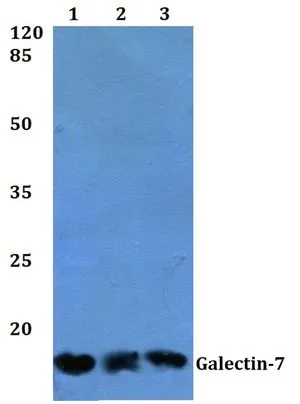 WB analysis of various samples using GTX66682 Galectin 7 antibody. Lane1 : HEK293T whole cell lysate Lane2 : Raw264.7 whole cell lysate Lane3 : H9C2 whole cell lysate Dilution : 1:500