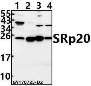 WB analysis of various samples using GTX66685 SFRS3 antibody. Lane1 : U-87MG whole cell lysate(40ug) Lane2 : Jurkat whole cell lysate(40ug) Lane3 : C6 whole cell lysate(40ug) Lane4 : BV2 whole cell lysate(40ug) Dilution : 1:500