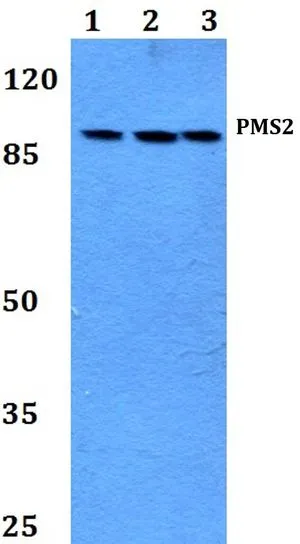 WB analysis of various samples using GTX66694 PMS2 antibody. Lane1 : A549 whole cell lysate Lane2 : Raw264.7 whole cell lysate Lane3 : H9C2 whole cell lysate Dilution : 1:500