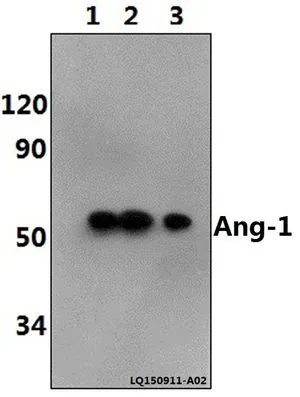 WB analysis of various samples using GTX66700 Angiopoietin 1 antibody. Lane1 : PC12 whole cell lysate(40ug) Lane2 : NIH-3T3 whole cell lysate(40ug) Lane3 : Hela whole cell lysate(40ug) Dilution : 1:500