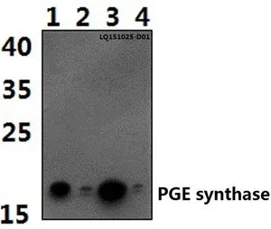 WB analysis of various samples using GTX66701 PTGES antibody. Lane1 : NIH-3T3 whole cell lysate(40ug) Lane2 : Hela whole cell lysate(40ug) Lane3 : H9C2 whole cell lysate(40ug) Lane4 : SP2/0 whole cell lysate(40ug) Dilution : 1:500 WB analysis of various samples using GTX66701 PTGES antibody. Lane1 : NIH-3T3 whole cell lysate(40ug) Lane2 : Hela whole cell lysate(40ug) Lane3 : H9C2 whole cell lysate(40ug) Lane4 : SP2/0 whole cell lysate(40ug) Dilution : 1:500