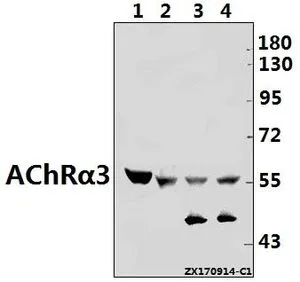 WB analysis of various samples using GTX66702 AChR alpha 3 antibody. Lane1 : The Brain tissue lysate of Mouse(40ug) Lane2 : C6 whole cell lysate(40ug) Lane3 : A549 whole cell lysate(40ug) Lane4 : Hela whole cell lysate(40ug) Dilution : 1:500 WB analysis of various samples using GTX66702 AChR alpha 3 antibody. Lane1 : The Brain tissue lysate of Mouse(40ug) Lane2 : C6 whole cell lysate(40ug) Lane3 : A549 whole cell lysate(40ug) Lane4 : Hela whole cell lysate(40ug) Dilution : 1:500