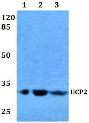 WB analysis of various samples using GTX66704 UCP2 antibody. Lane1 : HEK29T whole cell lysate Lane2 : Raw264.7 whole cell lysate Lane3 : PC12 whole cell lysate Dilution : 1:500