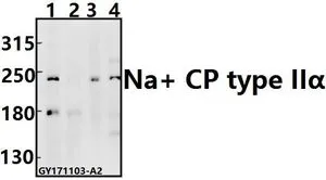 WB analysis of various samples using GTX66721 Nav1.2 antibody. Lane1 : HEK293T whole cell lysate(40ug) Lane2 : A549 whole cell lysate(40ug) Lane3 : C6 whole cell lysate(40ug) Lane4 : CT26 whole cell lysate(40ug) Dilution : 1:1000